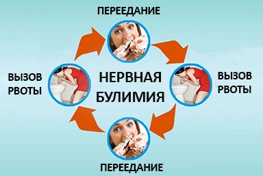 Лечение булимии в Буинске